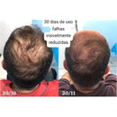 Tônico Poderoso - Gold Spel