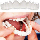 Lente de Contato Dental | Snap On Smile | Removível Inferior e Superior– Resina Tooth
