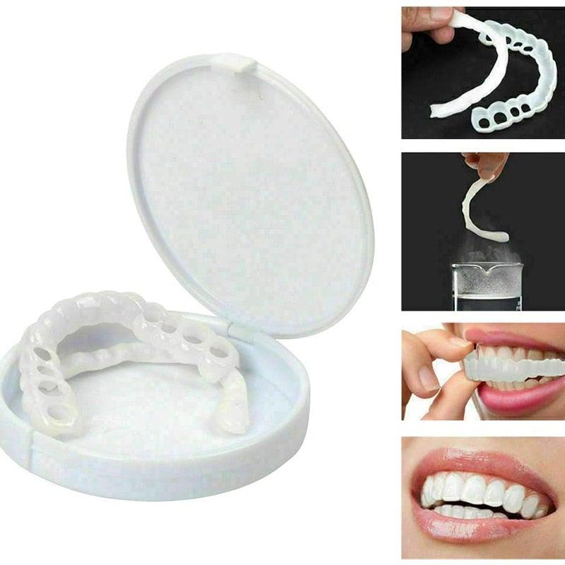Lente de Contato Dental | Snap On Smile | Removível Inferior e Superior– Resina Tooth