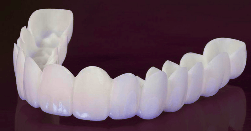 Lente de Contato Dental | Snap On Smile | Removível Inferior e Superior– Resina Tooth